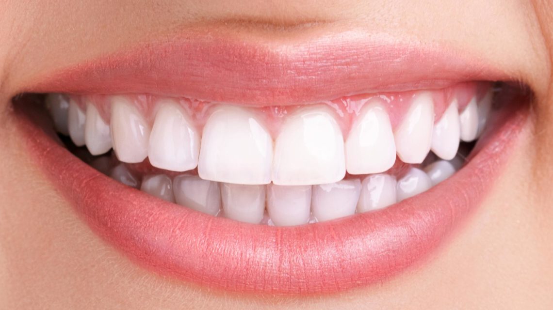 بلیچینگ یا سفید کردن دندان