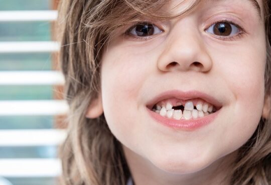 ترومای دندان کودکان