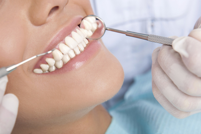 لمینت دندان و پوسیدگی دندان 