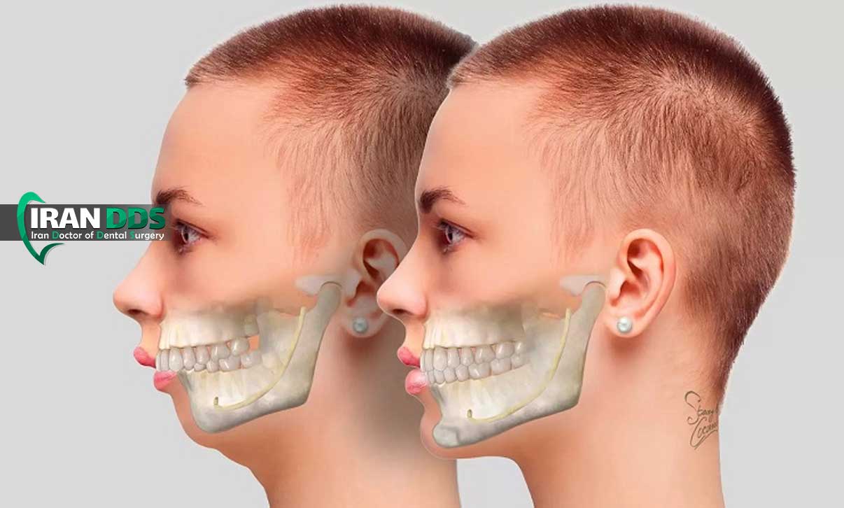 جراحی فک برای اصلاح ناهنجاری های مادرزادی