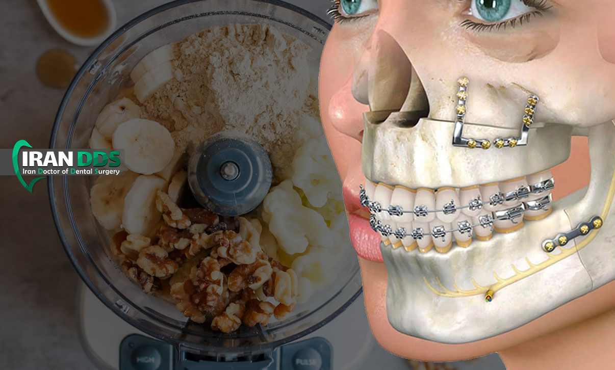 بهترین تغذیه بعد جراحی فک و دندان چیست؟ راهنمای کامل رژیم غذایی نرم و مقوی