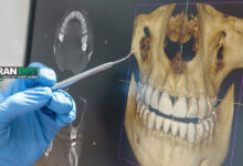 نقش فناوری تصویربرداری سه بعدی در تشخیص و جراحی فک