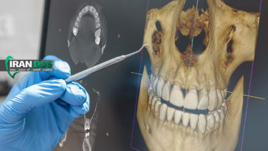 نقش فناوری تصویربرداری سه بعدی در تشخیص و جراحی فک