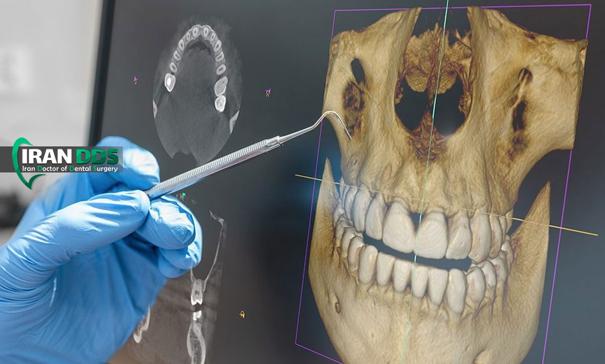 نقش فناوری تصویربرداری سه بعدی در تشخیص و جراحی فک