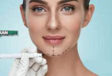 جراحی زیبایی برای درمان خطوط لب و چانه