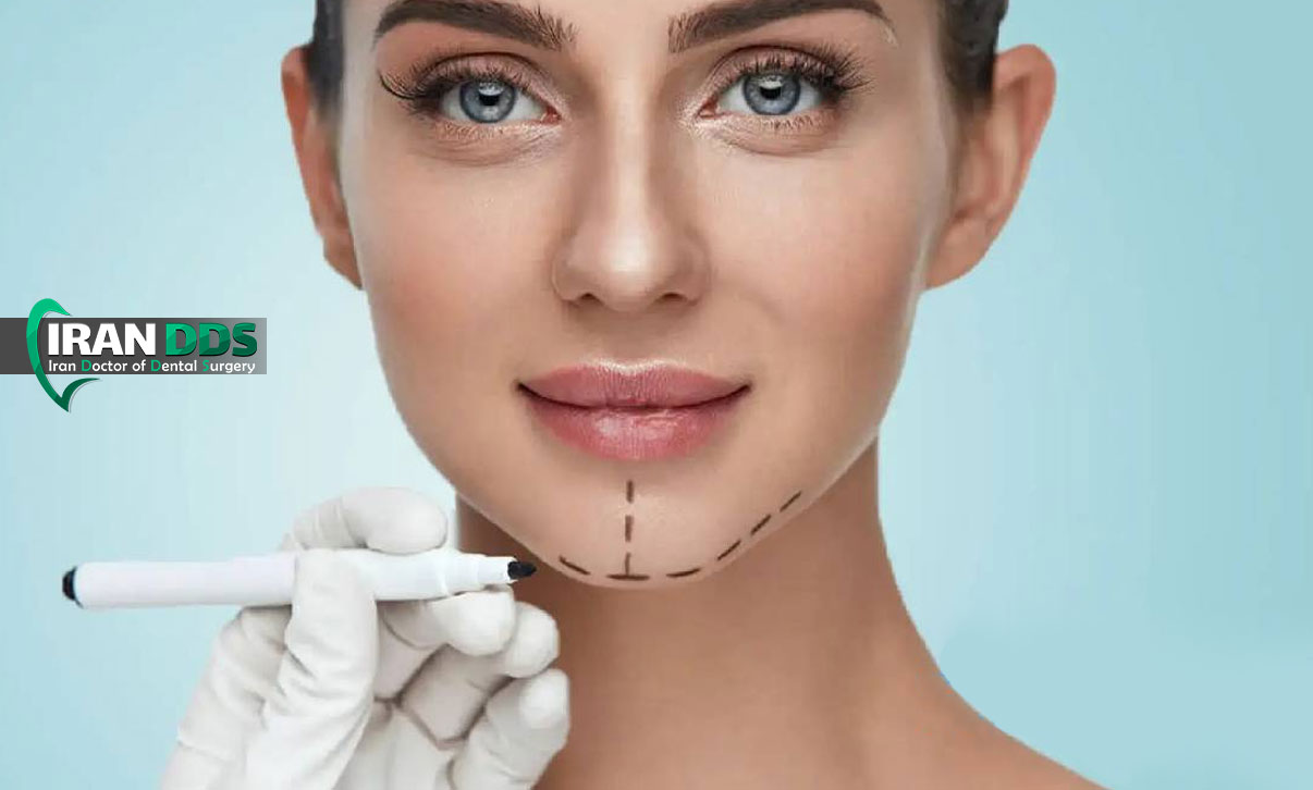 جراحی زیبایی برای درمان خطوط لب و چانه